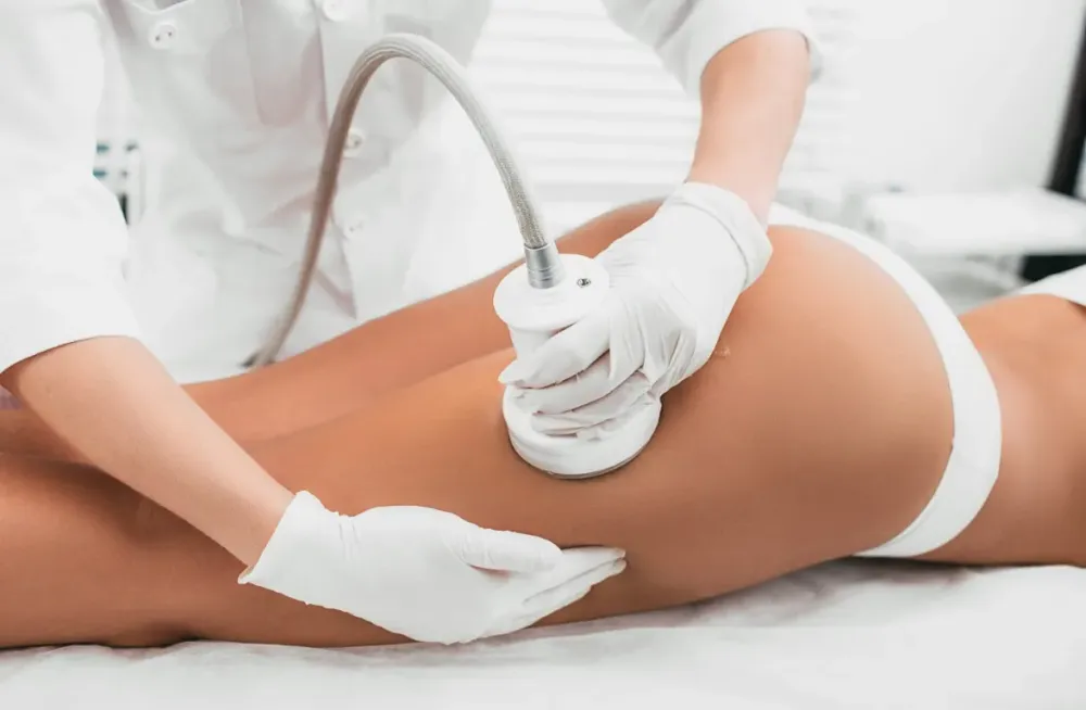 Traitement de la cellulite à Paris